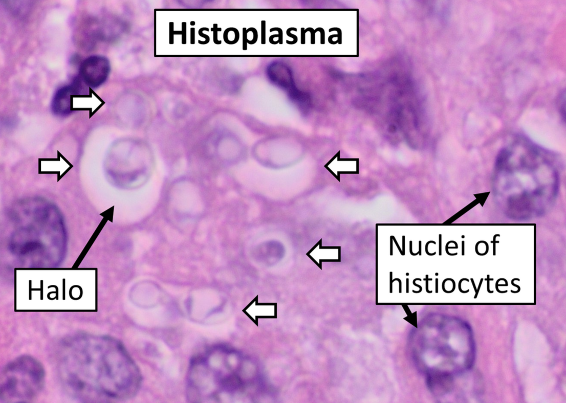 Histoplasma